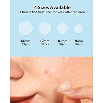 LitBear Acne Pimple Patches- Day and Night 4 Sizes 180 Dots Thin & Thick Hydrocolloid Patches with Witch Hazel, Tea Tree & Calendula Oil, Extra Adhesion for Face Zit Patch Dots