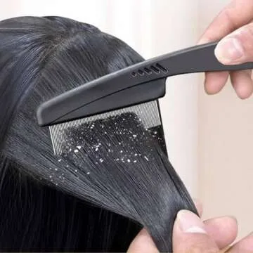 Yumflan Dandruff Comb, Stainless Steel Fine Tooth Dandruff Remover, Professional Scalp Comb Hair Comb for Kids and Adults (Black)