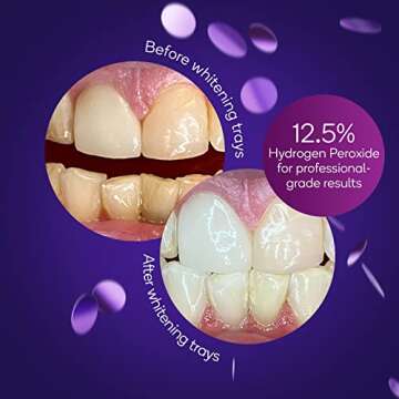 BURST Sensitive Teeth Friendly Whitening Kit | 7 Treatments with 12.5% Hydrogen Peroxide | Results i...