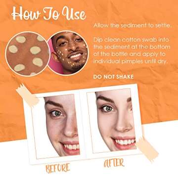 Bye Bye Blemish Dark Spot Lotion for Bright Skin Treatment