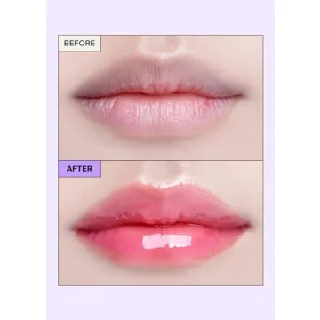 I DEW CARE Korean Lip Oil Gloss for Juicy Hydration