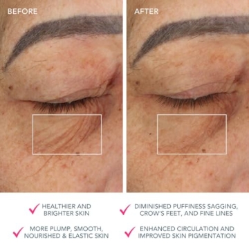 FOREO Bear Microcurrent Facial Device for Instant Face Lift