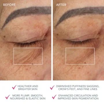 FOREO Bear Microcurrent Facial Device for Instant Face Lift