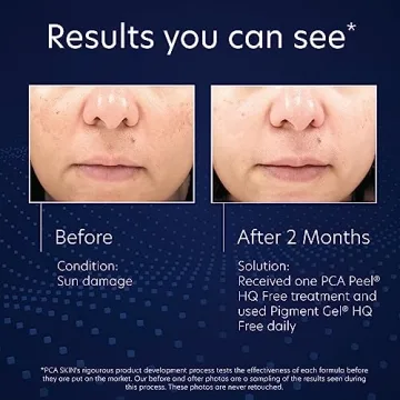 PCA SKIN Hydroquinone-Free Pigment Gel for Dark Spots