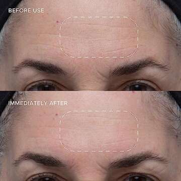 Alpyn Wild Huckleberry 8-Acid Polishing Peel | Double Exfoliating Peel Mask to Visibly Smooth & Brighten Skin While Refining the Look of Pores | 1.7 oz / 50 ml