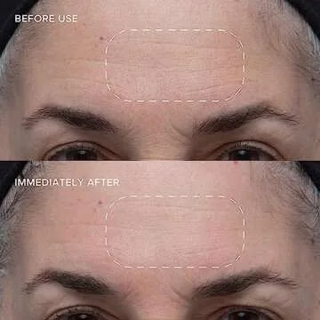 Alpyn Wild Huckleberry 8-Acid Polishing Peel | Double Exfoliating Peel Mask to Visibly Smooth & Brighten Skin While Refining the Look of Pores | 1.7 oz / 50 ml