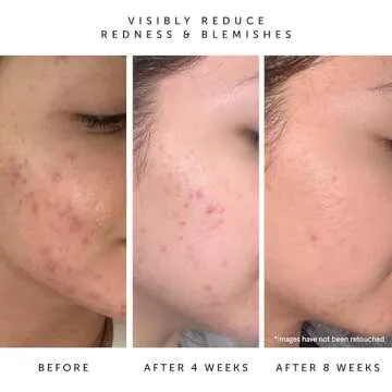 HERBIVORE Lapis Blue Tansy Face Oil – Skin-Balancing Moisturizer for Oily, Acne-Prone Skin | Redness Soothing, Azulene-Rich, Plant-based, Vegan, Cruelty-free, 50 mL / 1.7 oz