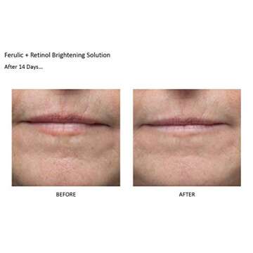 Dr Dennis Gross Ferulic + Retinol Brightening Solution: for Fine Lines, Rough Texture, and Uneven Tone, 1.0 fl oz