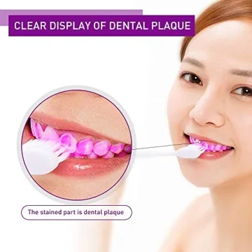 Y-Kelin Dental Plaque Disclosing Tablets for Kids and Adults
