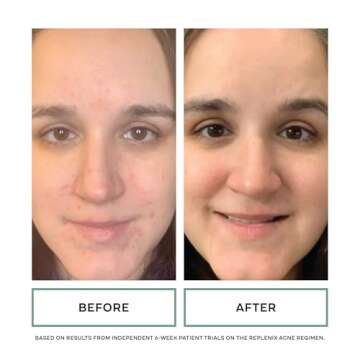 Replenix Gly-Sal 5-2 Clarifying Pads, Medical-Grade Exfoliating Cleansing Wipes for Acne-Prone Skin, Oil-Free Facial Treatment with Witch Hazel, 5% Glycolic & 2% Salicylic Acids (60 ct.)