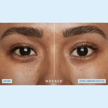 NuFACE Power Move Bundle - Includes Hydra-Gel Power Patches, Fix Microcurrent Device & Fix Serum - For On-The-Go Treatment of Forehead Lines, Crow's Feet, Under Eyes, Smile Lines & More (3 Count)