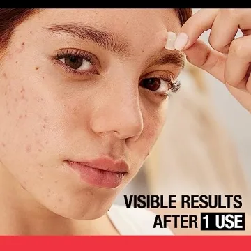 Neutrogena Stubborn Acne Pimple Patches, 24 Hydrocolloid Stickers