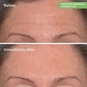 Murad Targeted Wrinkle Corrector - Resurgence Anti-Wrinkle Face Cream - Instant Filler Wrinkle Corrector - Gentle Anti-Aging Hydrating Hyaluronic Acid Treatment Backed by Science, 0.5 Oz