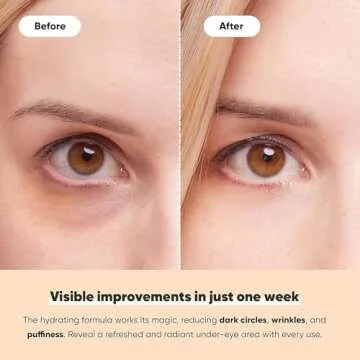 LE GUSHE Under Eye Patches - Gold Under Eye Masks for Dark Circles and Puffiness - With Collagen & Amino Acids - Gifts for Women - Bridesmaid Gifts (20 pairs)