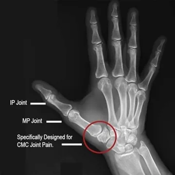 Comfort Cool Thumb Splint for Arthritis & Tendinitis