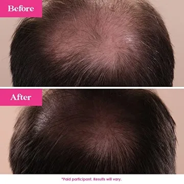 GrandeHAIR Hair Enhancing Serum for Thicker Hair
