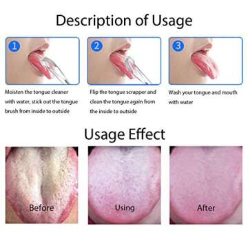 Fanzbike Tongue Cleaner Tongue Scraper - Stainless Steel Tongue Brush Eliminate Bad Breath With Non-synthetic Grip