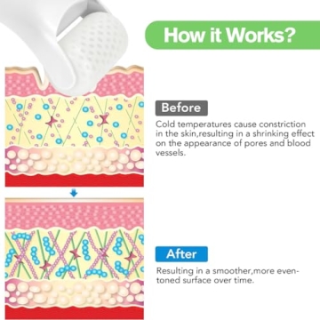 Fronnor Ice Roller for Revitalizing Skin and Relief