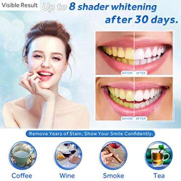 EZGO 10 Pack Teeth Whitening Gel Refills 22% Bleaching Gel, No Sensitive Teeth Whitener, Great for S...