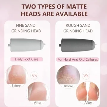 Electric Pedicure Tool Set with Rechargeable Foot Care