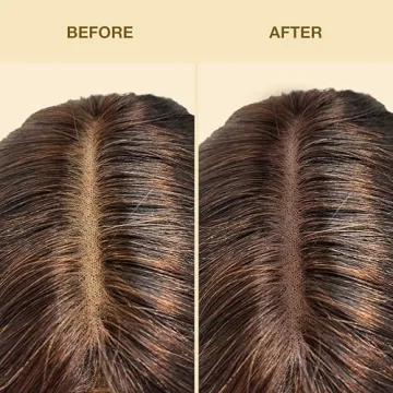 EBIN Tinted Lace Spray Medium Dark Brown - Quick Drying & Natural Looking