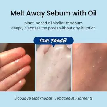 coxir ULTRA HYALURONIC CLEANSING OIL 5.07 fl.oz + BLACK RICE TXA PORE PURIFYING MASK l Blackheads, Pore Clearing, Deep Cleansing, Korean Skincare