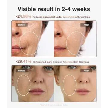 JOVS 4D Laser Light Therapy Mask, Red Light Therapy for Face with 4 Different Wavelength Adopted FPT Concentrated Technology, 3 Modes Portable Face Mask for Anti-aging