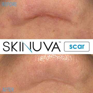 Skinuva® Next Generation Scar Cream - Advanced Scar Silicone Cream Matrix Formulated with Growth Factors (1.7 oz)