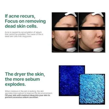 SOME BY MI AHA BHA PHA 30 Days Miracle Toner - Pack of 2 - Mild Exfoliating Korean Toner for First Skin Care Step - Daily Blackhead Removing Pore Minimizer for Face Skin Texture - Korean Skin Care