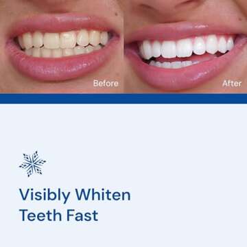 SNOW Diamond Teeth Whitening Strips | Gentle & Enamel Safe White Strips for Teeth Whitening | at-Hom...