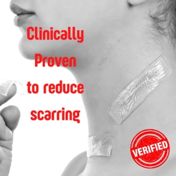 SilverSeal Hydrogel Pads - Soothing Silver Burn Dressings