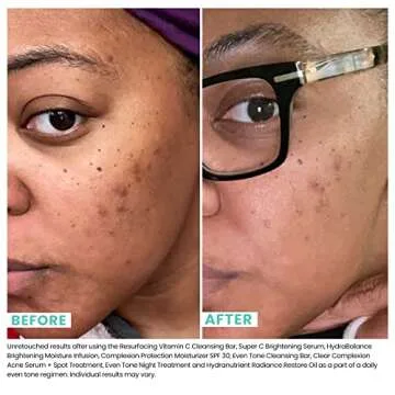 Pro Strength USRx®, Super C Brightening Serum, Lightweight Anti-Aging Daily Glow Serum | Hydrates, Brightens, Clarifies, and Evens Skin Tone with Hyaluronic Acid and Salicylic Acid, 1.0 Fl Oz