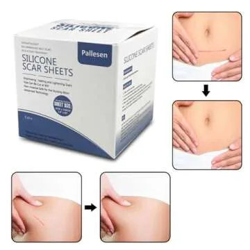 Pallesen Silicone Scar Sheets for Safe Scar Treatment