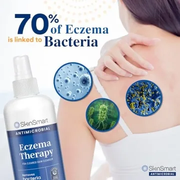 SkinSmart Eczema Therapy Spray for Quick Skin Relief
