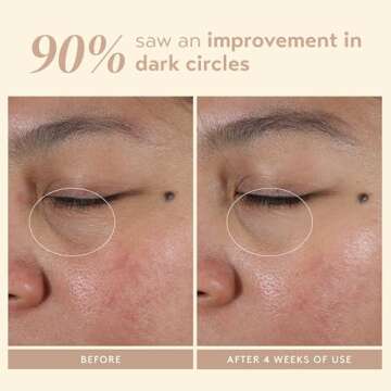 SHANI DARDEN SKINCARE Intensive Eye Renewal Cream, Anti-Aging Eye Cream for Fine Lines, Crow’s Feet and Dark Circles, Crease-Free and Makeup-Ready, 0.50 fl oz