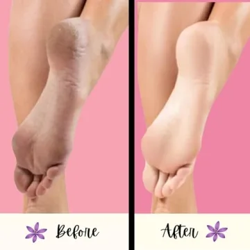 Mr. Pumice Puma Bar 6-pack for Smooth, Beautiful Feet