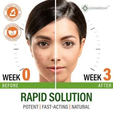 Acne Supplements for Clear Skin with Biotin, Zinc, Vitamin A & Niacin - Acne Pills for Acne Scar Treatment - Cystic Acne Treatment with Probiotics for Gut Health & Glowing Skin - Made in USA - 60 Caps