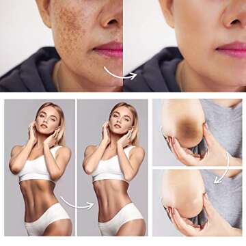 Famirosa Dark Spot Corrector Cream for Radiant Skin