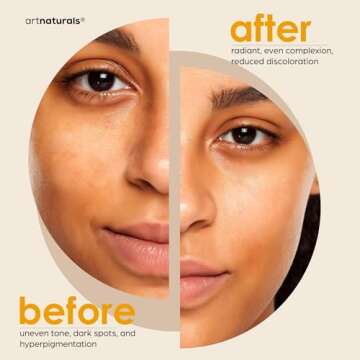 Artnaturals Kojic Acid Soap + African Net Sponge (2 pack X 142g Turmeric bars) Dark spot remover & Scars - Original Japanese Complex Vitamin C, Hyaluronic Acid, retinol, shea butter (Citrus)