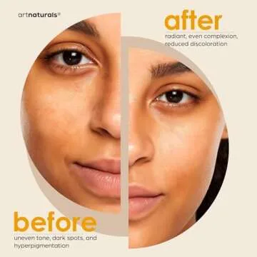 Artnaturals Kojic Acid Soap + African Net Sponge (2 pack X 142g Turmeric bars) Dark spot remover & Scars - Original Japanese Complex Vitamin C, Hyaluronic Acid, retinol, shea butter (Citrus)