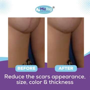Breast Surgery Recovery Supplies - Silicone Sheets for Healing - Augmentation Essentials - Comfortable Under Post-Op Bra