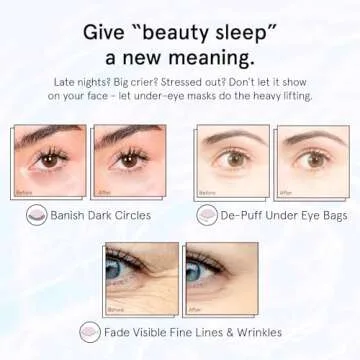 Grace & Stella Under Eye Masks with Retinol for Youthful Glow