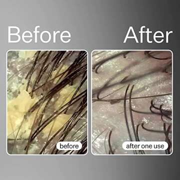 ACT+ ACRE Cold Processed Balancing Shampoo - Clarifying Cleanse for Build Up - Sulfate Free Gentle Hair Treatment with Moringa Oil - Moisturize and Strengthen Damaged Hair (10 Fl.oz)