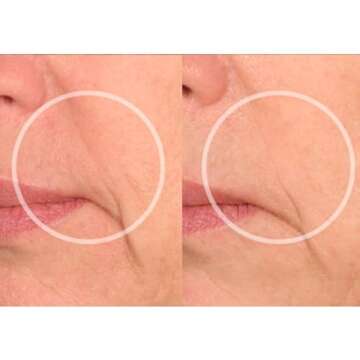 SiO Beauty Eye and Smile Lift Anti-Wrinkle Patches 4 Week Supply - Overnight Under Eye Mask Pads For Dark Circles - Silicone Skin Treatment For Wrinkles