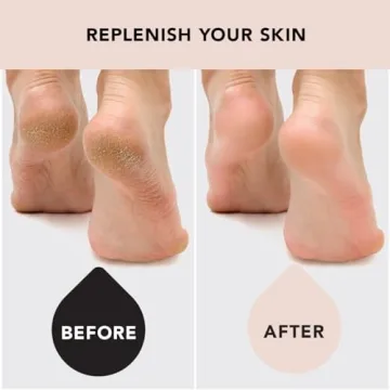 Kitsch Moisturizing Socks for Hydration & Comfort