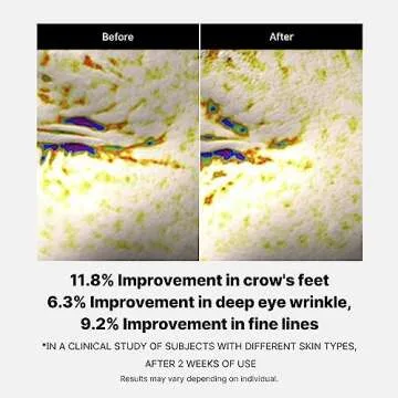 medicube Deep Reviving Peptide Eye Serum 1.01 Fl. Oz., | Eye Treatment Serum with Quadruple Peptides, Niacinamide, and Squalane | Reduces Signs of Aging and Fine Lines