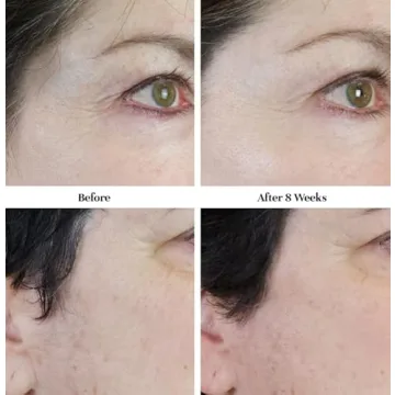 City Beauty Line-Blurring Wrinkle Filler for Youthful Skin