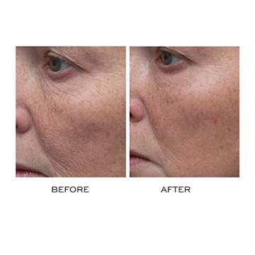 ELEMIS Peptide4 Thousand Flower Treatment for Radiant Skin