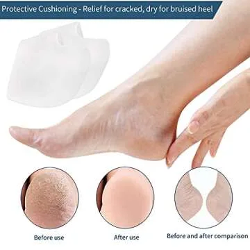 GQTJP Silicone Heel Protector Heel Cups, Heel Pads for Plantar Fasciitis Relief, Heel Sleeves for Heel Spurs, Heel Pain, Heal Dry Cracked Heels, Achilles Tendinitis (White - 2 Pairs)