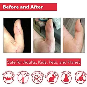 Puremedy Original Healing Ointment All Natural First Aid Salve for Wounds, Burns, Cuts, Bug Bites, Bed Sores, Itching, Swelling - Safe for Adults & Kids, FSA - 1 oz